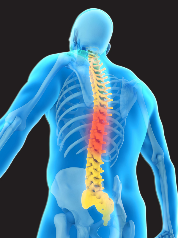 Post-Laminectomy Syndrome