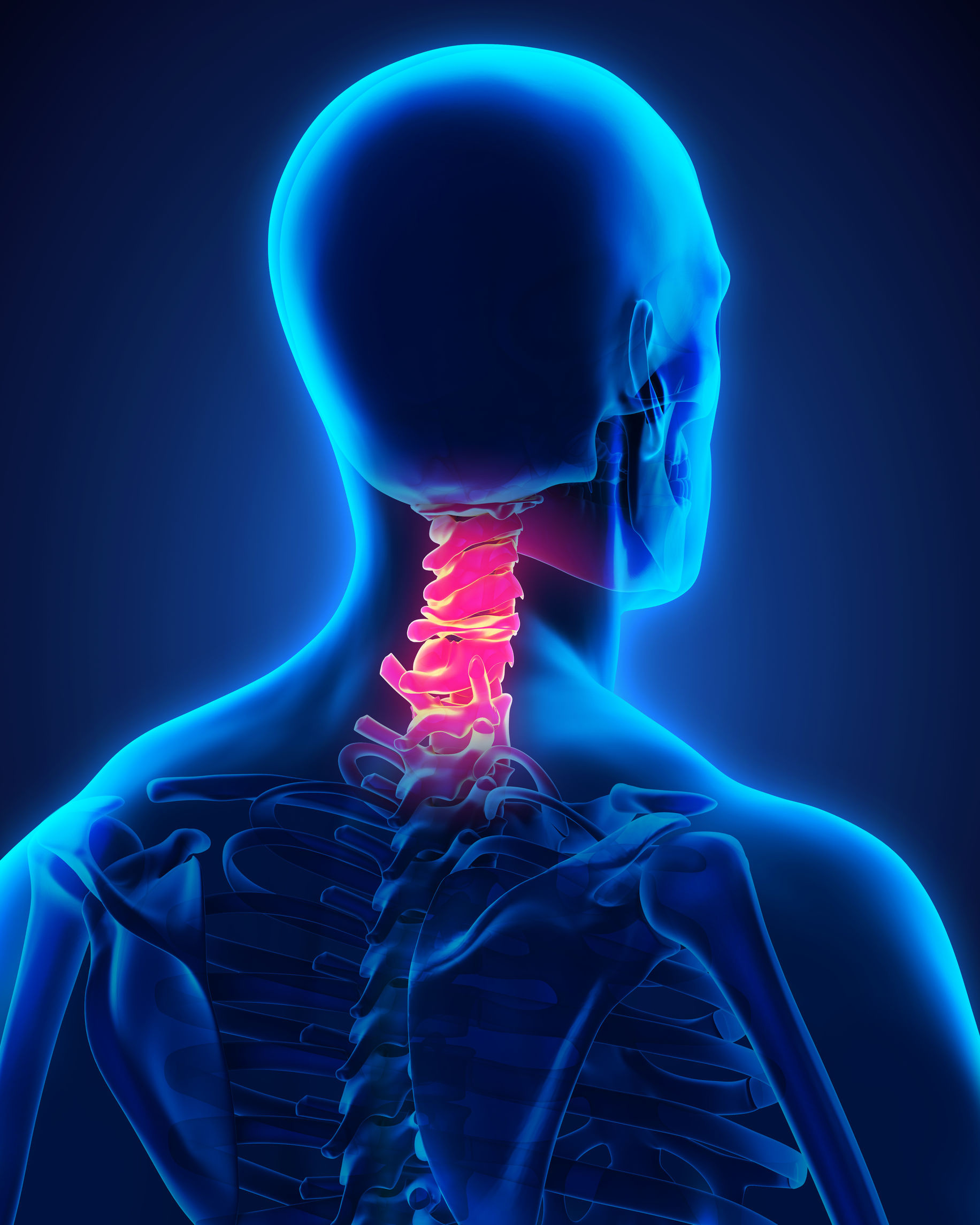 Cervical Laminectomy and Fusion