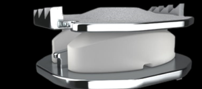 Cervical Disc Replacement