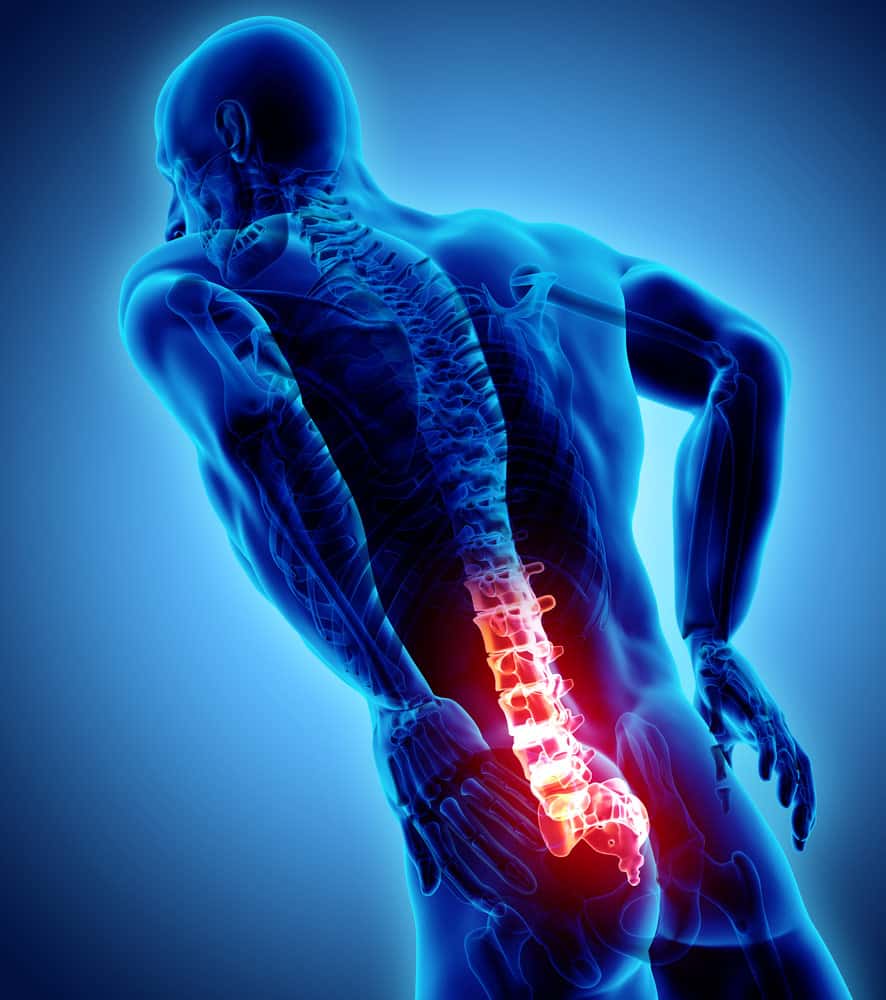 Lumbar Laminectomy & Decompression